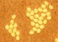 Newly laid Mulberry silkworm eggs | Wild Fibres natural fibres